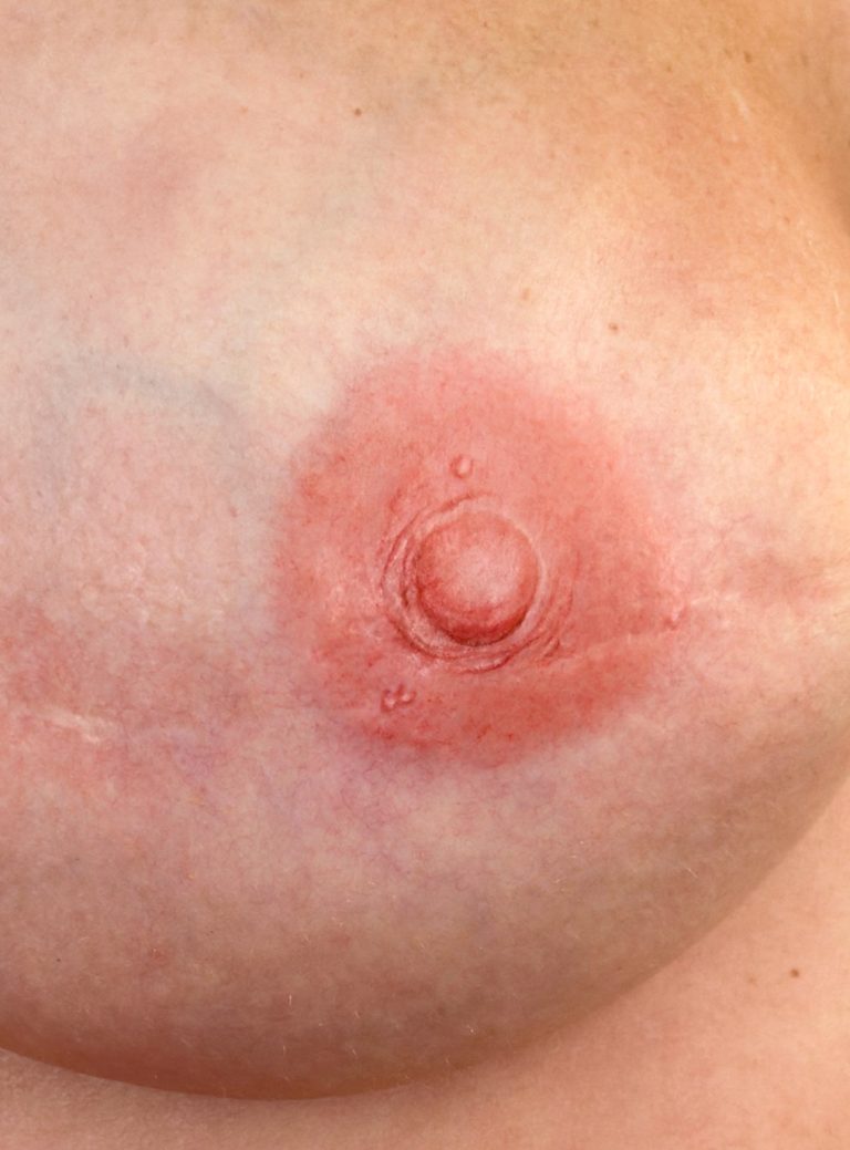 3d-areola-tattoo